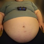 HeavyBelly, a 565lbs foodie From Poland