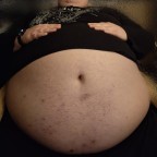 HeavyBelly, a 565lbs foodie From Poland
