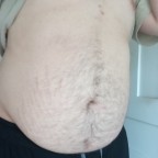 DrJackBrightSCP963, a 280lbs feedee From United States