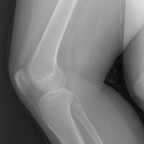 IllusorySister, a 200lbs fat appreciator From United States